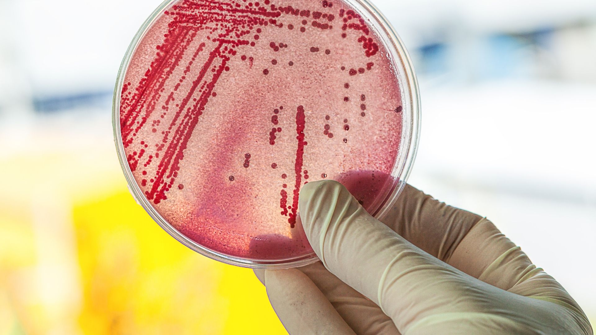 How to Clean a Beauty Blender, Are You Using These 5 Tips? Stonegirl